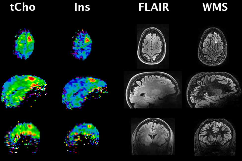 © Universitätsklinik für Neurochirurgie