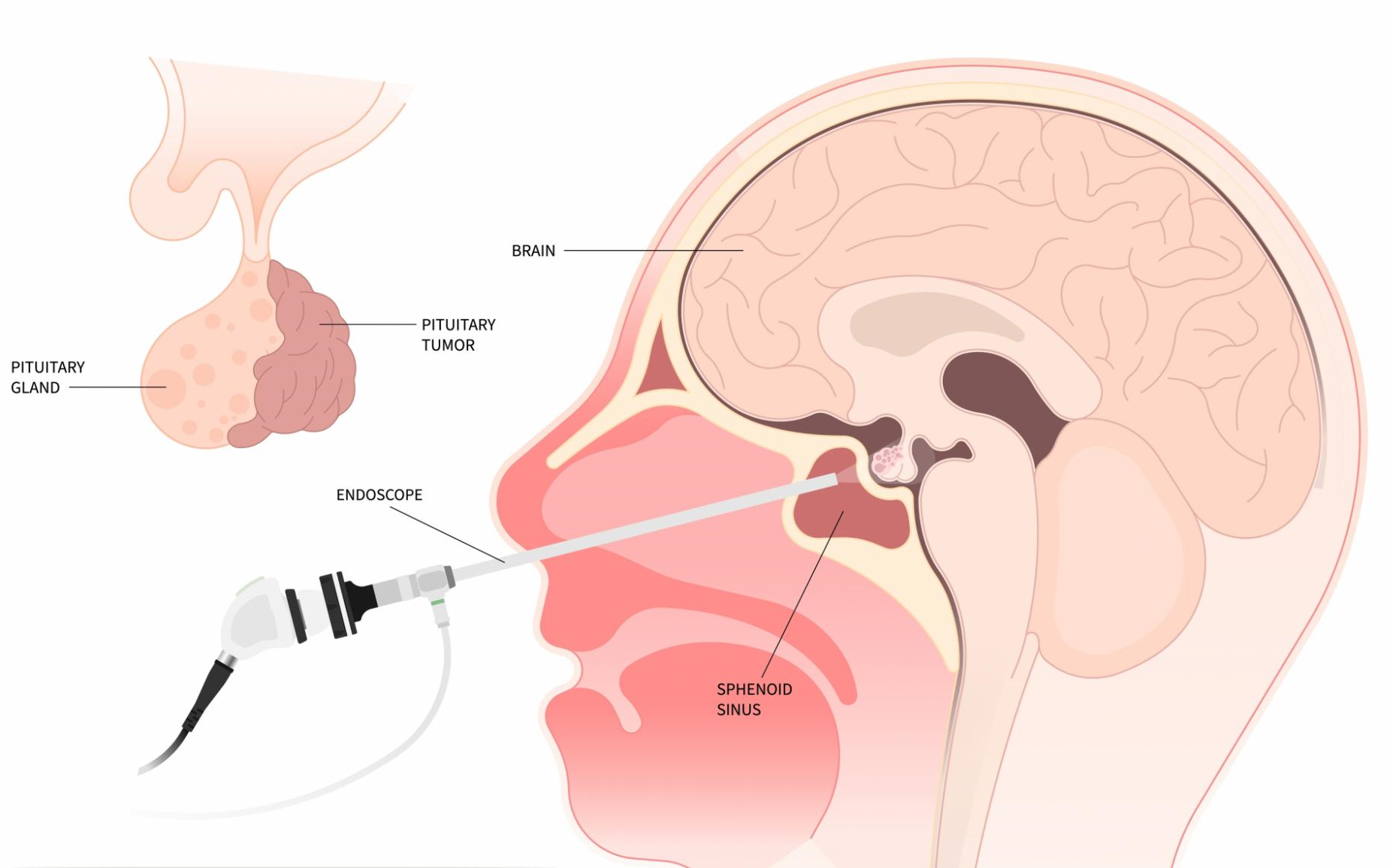 © Pepermpron/Shutterstock.com