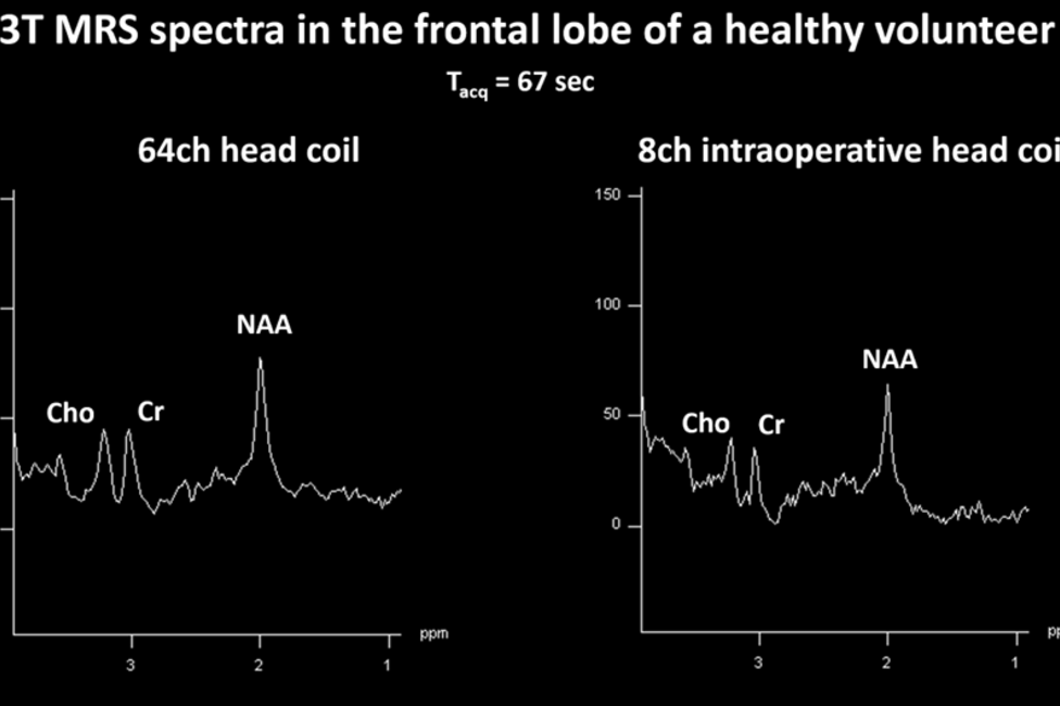 © Universitätsklinik für Neurochirurgie