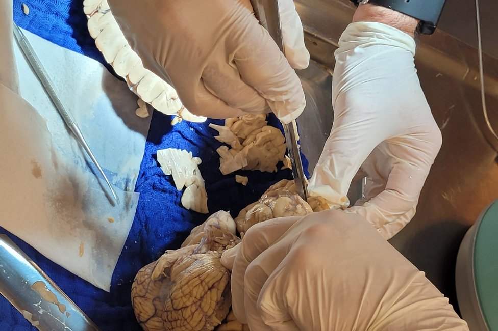 © Universitätsklinik für Neurochirurgie © Universitätsklinik für Neurochirurgie